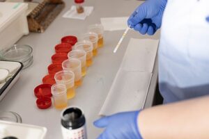 drug testing is mandatory after a workplace accident