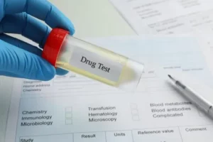 Workers Compensation Drug Test